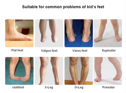 Child Girl Sandals Boys Children's Orthopedic Shoes Summer Toddler Flower Design Princess Flatfeet Footwear 2 To 8Years Age
